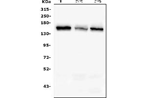 Western blot analysis of RAB3GAP2 using anti-RAB3GAP2 antibody (ABIN6719633).