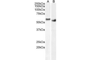 ABIN185178 (2µg/ml) staining of nuclear HEK293 (A) and (1ug/ml) Human Breast cancer (B) lysate (35µg protein in RIPA buffer). (STK35 antibody  (C-Term))