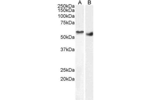 STK35 antibody  (C-Term)