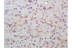 Formalin-fixed and paraffin embedded rat brain labeled with Anti-Phospho-Dab1 (Tyr198)Polyclonal Antibody, Unconjugated  at 1:200 followed by conjugation to the secondary antibody and DAB staining (DAB1 antibody  (pTyr198))