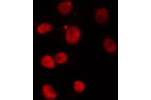 ABIN6274301 staining Hela cells by IF/ICC. (PITX1 antibody  (Internal Region))