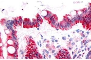 Immunohistochemical (Formalin/PFA-fixed paraffin-embedded sections) staining in human colon, epithelium with PTGDR polyclonal antibody . (PTGDR antibody  (3rd Extracellular Domain))