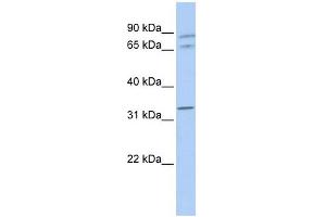 GJA4 antibody used at 1 ug/ml to detect target protein. (GJA4 antibody  (Middle Region))