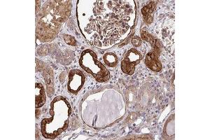Immunohistochemical staining of human kidney with TRIP6 polyclonal antibody  shows strong cytoplasmic and membranous positivity in cells in tubules and cells in glomeruli at 1:50-1:200 dilution.