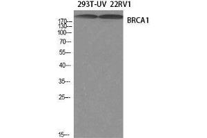 Western Blot analysis of 293T-UV, 22RV1 cells using BRCA1 Polyclonal Antibody at dilution of 1:1000. (BRCA1 antibody)