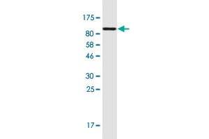 Western Blot detection against Immunogen (94. (Plastin 3 antibody  (AA 1-630))