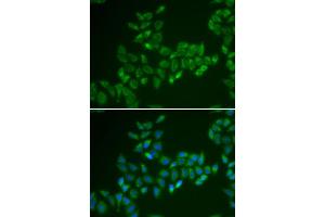 Immunofluorescence analysis of HeLa cells using CRAT antibody (ABIN5973772).