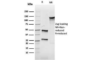 SDS-PAGE Analysis Purified Aurora B Recombinant Mouse Monoclonal Antibody (rAURKB/1592).