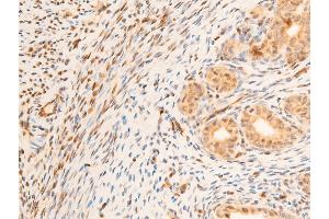 ABIN6267218 at 1/100 staining rat uterine tissue sections by IHC-P.