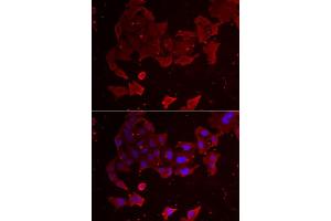 Immunofluorescence analysis of A549 cells using FLCN antibody (ABIN5973885).