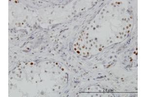 Immunoperoxidase of monoclonal antibody to BRD3 on formalin-fixed paraffin-embedded human testis. (BRD3 antibody  (AA 418-556))