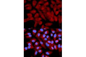 Immunofluorescence analysis of U2OS cells using EIF5A antibody (ABIN5971052). (EIF5A antibody)