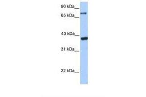 Image no. 1 for anti-Death Inducer-Obliterator 1 (DIDO1) (AA 480-529) antibody (ABIN6737879) (DIDO1 antibody  (AA 480-529))