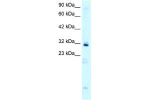 WB Suggested Anti-HOXB9 Antibody Titration:  0. (HOXB9 antibody  (N-Term))