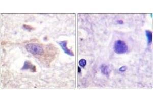 Immunohistochemistry analysis of paraffin-embedded human brain tissue, using GRB10 (Ab-67) Antibody. (GRB10 antibody  (AA 33-82))