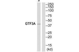 Western blot analysis of extracts from Jurkat cells, using GTF3A antibody. (GTF3A antibody)