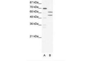 Image no. 1 for anti-Zinc Finger and BTB Domain Containing 43 (ZBTB43) (AA 151-200) antibody (ABIN202596)