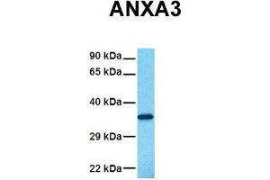 Host:  Rabbit  Target Name:  ANXA3  Sample Tissue:  Human Fetal Lung  Antibody Dilution:  1. (Annexin A3 antibody  (N-Term))