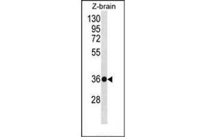 Western blot analysis of HOXD10 Antibody (C-term) in Zebrafish brain tissue lysates (35ug/lane). (HOXD10 antibody  (C-Term))