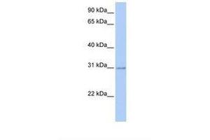 Image no. 1 for anti-Homeobox C11 (HOXC11) (AA 182-231) antibody (ABIN6737662) (HOXC11 antibody  (AA 182-231))