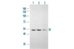Western blot using  Affinity Purified anti-GSK3A antibody shows detection of a 52 kDa band corresponding to human GSK3A in various human derived 293T cell extracts. (GSK3 alpha antibody  (pSer21))