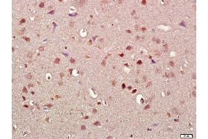 Paraformaldehyde-fixed, paraffin embedded rat brain, Antigen retrieval by boiling in sodium citrate buffer (pH6. (SNCA antibody  (AA 51-90))