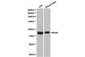 Western Blotting (WB) image for anti-Retinitis Pigmentosa GTPase Regulator (RPGR) antibody (ABIN1874639) (RPGR antibody)