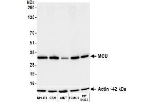anti-Mitochondrial Calcium Uniporter (MCU) (AA 300-350) antibody