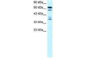 ZNF512 antibody used at 0. (ZNF512 antibody  (Middle Region))