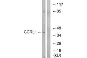 Western blot analysis of extracts from HepG2 cells, using CCRL1 Antibody. (CCRL1 antibody  (AA 291-340))
