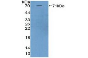 Detection of Recombinant ASPN, Mouse using Polyclonal Antibody to Asporin (ASPN) (Asporin antibody  (AA 16-373))