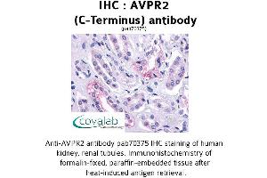 Image no. 1 for anti-Arginine Vasopressin Receptor 2 (AVPR2) (C-Term) antibody (ABIN1732154) (AVPR2 antibody  (C-Term))