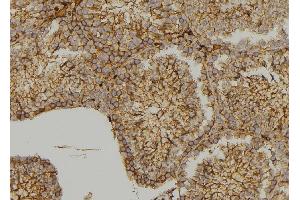 ABIN6279564 at 1/100 staining  testis tissue by IHC-P. (MYO3B antibody  (C-Term))
