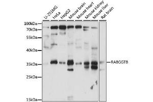 Western blot analysis of extracts of various cell lines, using RABGGTB antibody. (RABGGTB antibody)