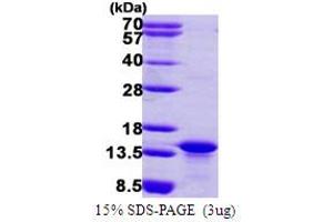 MYCBP Protein (AA 1-103) (His tag)