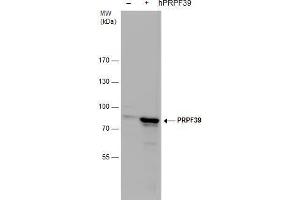 WB Image PRPF39 antibody detects PRPF39 protein by western blot analysis. (PRPF39 antibody)