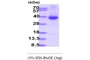 SDS-PAGE (SDS) image for Dickkopf Homolog 1 (DKK1) (AA 32-266) protein (His tag) (ABIN666746) (DKK1 Protein (AA 32-266) (His tag))