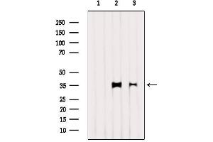 Western blot analysis of extracts from various samples, using LDHA  Antibody. (Lactate Dehydrogenase A antibody  (C-Term))