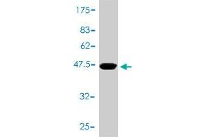 Western Blot detection against Immunogen (43. (TNNC1 antibody  (AA 1-161))