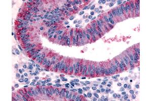 Anti-DKK1 antibody IHC of human uterus, endometrium. (DKK1 antibody  (N-Term))