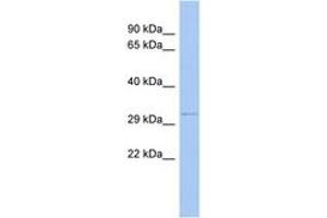 Image no. 1 for anti-Outer Dense Fiber of Sperm Tails 4 (ODF4) (N-Term) antibody (ABIN6743717) (ODF4 antibody  (N-Term))