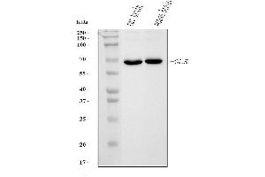 Western blot analysis of Glutaminase/GLS using anti-Glutaminase/GLS antibody (ABIN7601602). (Glutaminase antibody  (AA 396-654))