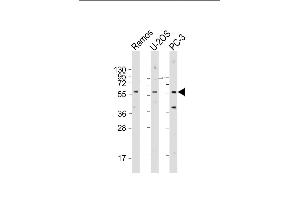 TRIM6 Antibody (N-term) (ABIN1881902 and ABIN2843419) western blot analysis in 293,A549,Ramos cell line lysates (35 μg/lane). (TRIM6 antibody  (N-Term))
