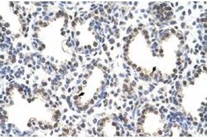 Immunohistochemical staining (Formalin-fixed paraffin-embedded sections) of human lung with FLJ12529 polyclonal antibody  at 4-8 ug/mL working concentration. (CPSF7 antibody  (C-Term))