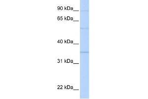 Prohibitin 2 antibody used at 1 ug/ml to detect target protein. (Prohibitin 2 antibody  (N-Term))