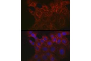 Immunofluorescence (IF) image for anti-Epithelial Cell Adhesion Molecule (EPCAM) (AA 40-260) antibody (ABIN3021638)