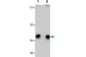 Western blot analysis of HEK293 cells with CHORDC1 polyclonal antibody  at (Lane 1) 1 and (Lane 2) 2 ug/mL dilution. (CHORDC1 antibody  (N-Term))