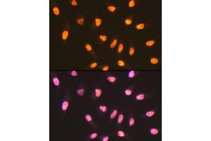 Immunofluorescence analysis of HeLa cells using MSH6 Rabbit mAb (ABIN7268709) at dilution of 1:100 (40x lens). (MSH6 antibody)