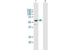 Western Blot analysis of EFHA2 expression in transfected 293T cell line by EFHA2 MaxPab polyclonal antibody. (EFHA2 antibody  (AA 1-530))