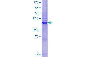 ZBTB8OS Protein (AA 1-136) (GST tag)